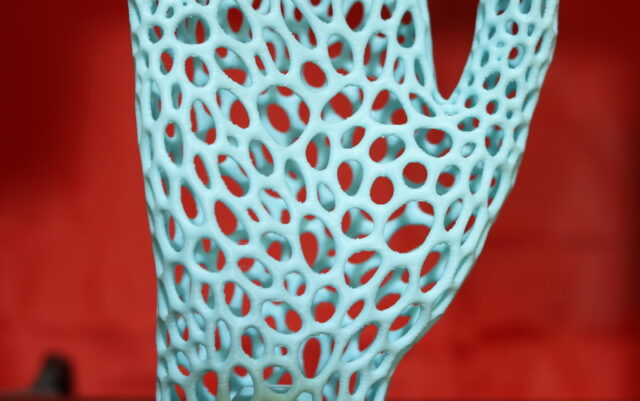 3D printed bionic hand using SUNLU APLA filament